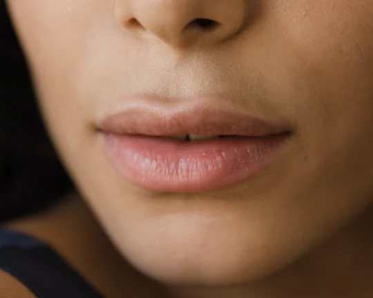 The Ultimate Lip Filler Guide: Benefits, Risks and Best Practices